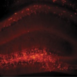 This is the CA1 region in an Alzheimer's mouse. The injected virus fluoresces under a microscope.